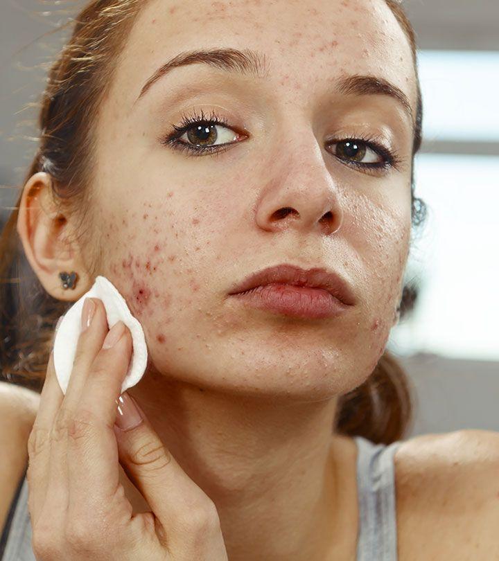 10 Skin Diseases for Women and Teenage Effective Guideline