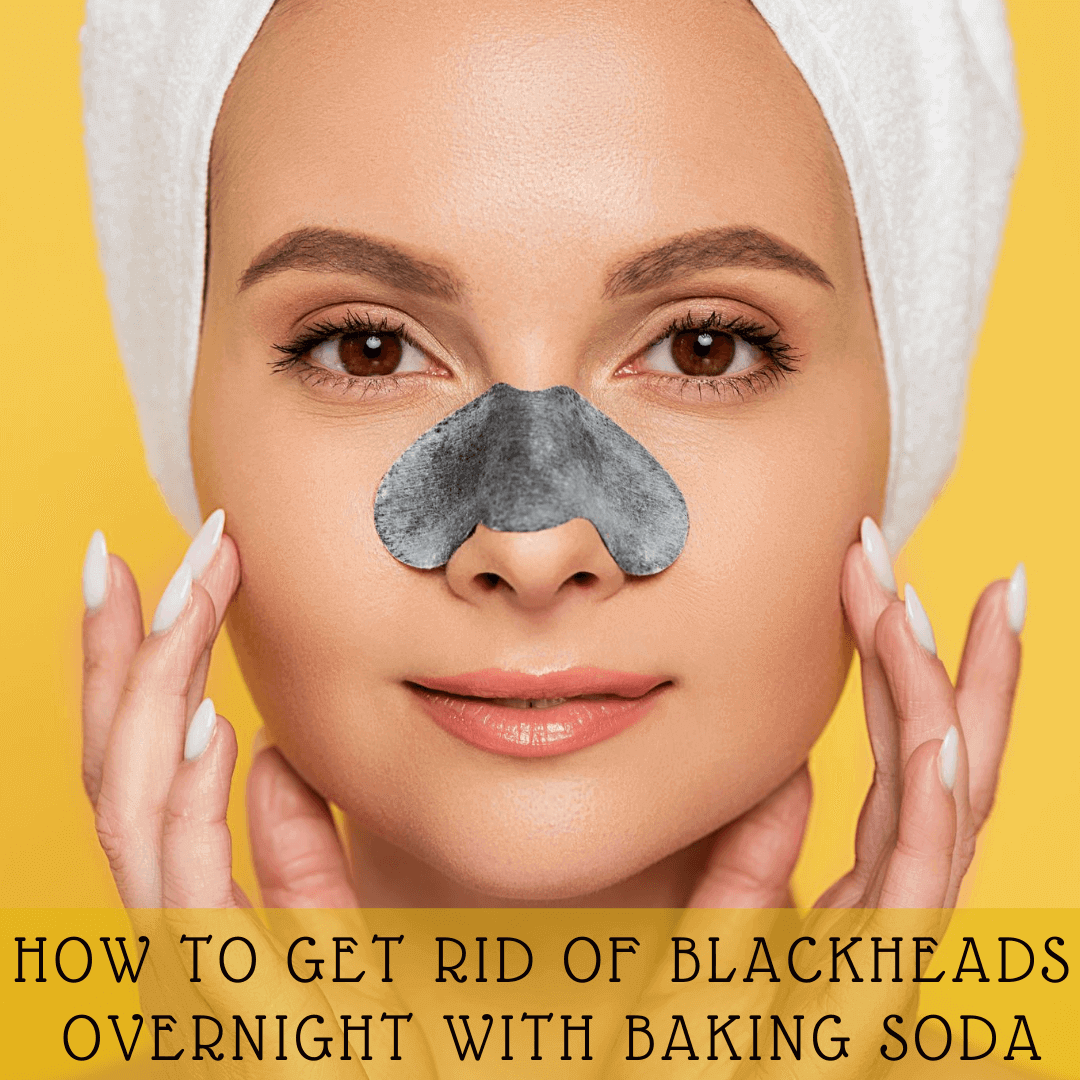 How to Get Rid Of Blackheads Overnight With Baking Soda