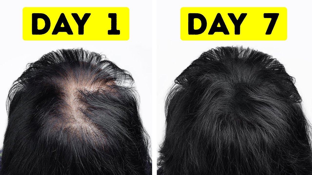 How to Thicken Hair 17 081665e3a4874ce19c70849c08f69c8c 081665e3a4874ce19c70849c08f69c8c