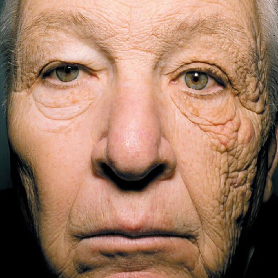 How to Prevent Truckers from Developing Skin Damage 6 1725f712325c470b8950b7e7e66bc5bc 1725f712325c470b8950b7e7e66bc5bc