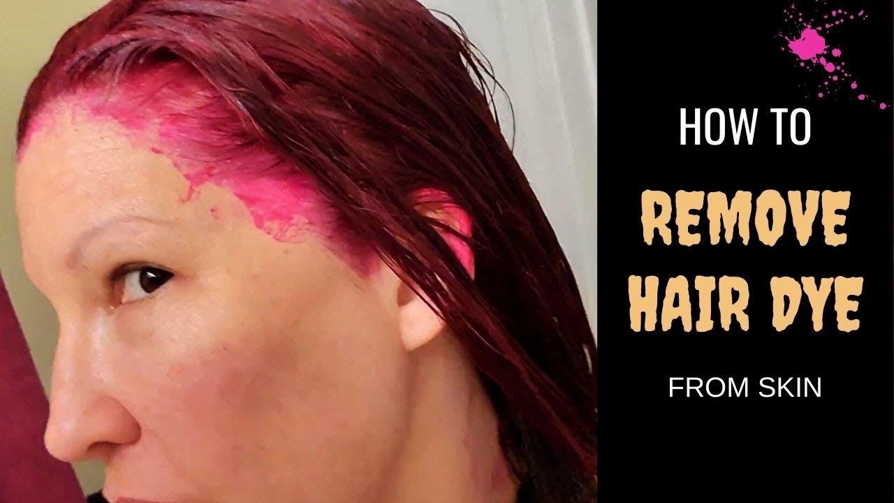 How to Get Hair Dye off Skin 8 1d151673aea44af1a62597b12910563a 1d151673aea44af1a62597b12910563a