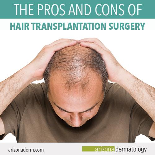 What are Disadvantages of Hair Transplant? 13 2372204c52cf42cbb26e3cf35ea7c0d9 2372204c52cf42cbb26e3cf35ea7c0d9