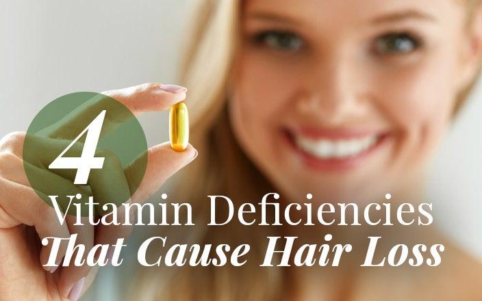 Which Vitamin Deficiency Causes Hair Loss 1 8863130a7ca94dd58c05b216551ef6c6 8863130a7ca94dd58c05b216551ef6c6