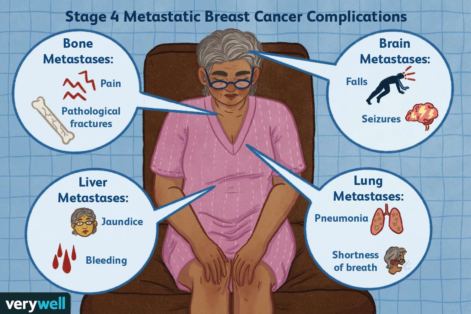 Signs of Metastatic Breast Cancer 1 c5deda4b877248269a7d6183a93cb0aa c5deda4b877248269a7d6183a93cb0aa
