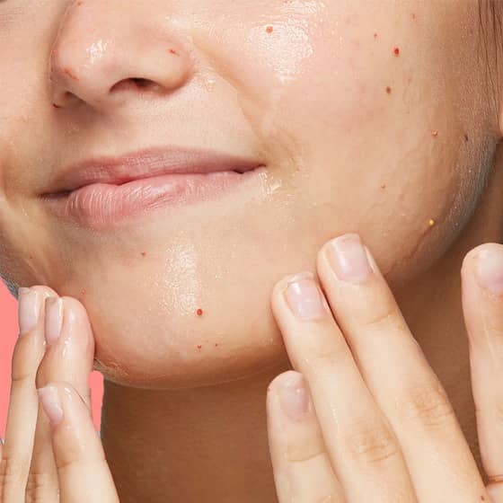 How to Address Common Skin Issues Associated With Dry Skin 1 e7e9ac1cf1d948669d5ad99e6758e90e e7e9ac1cf1d948669d5ad99e6758e90e