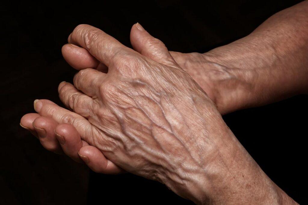 Thin Skin Causes Symptoms And Treatment