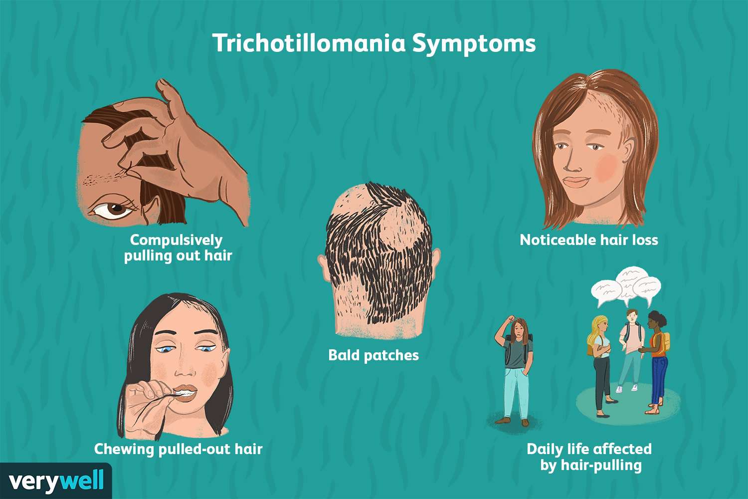 What Causes Hair Disorder? 1 b05a90b2daab4df78c1957d2231403ce b05a90b2daab4df78c1957d2231403ce