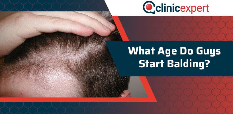 What Age Does Alopecia Start? 14 e7e53537049b42c492df36a5e4d8da07 e7e53537049b42c492df36a5e4d8da07