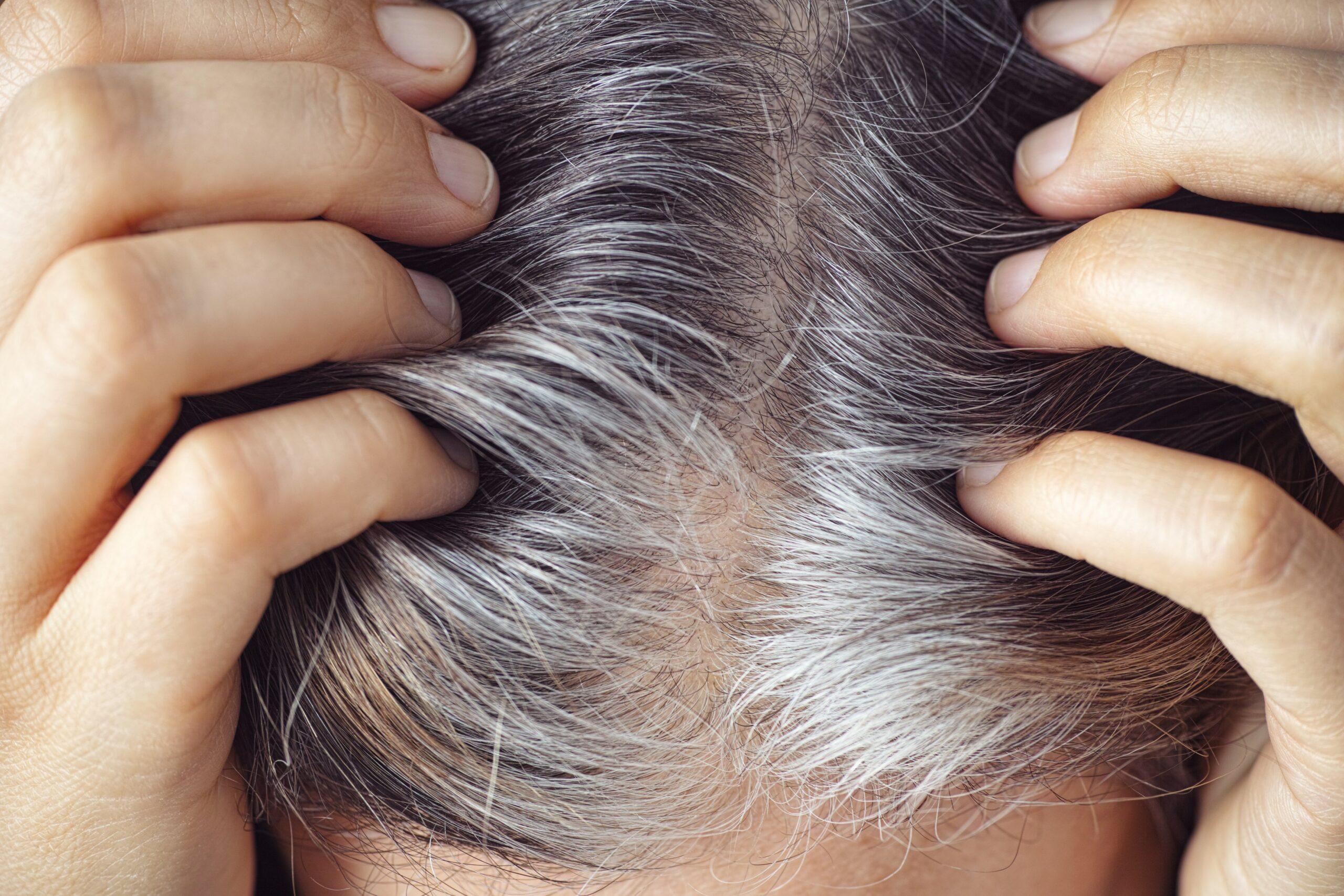 Why Hair Become White: Exploring the Science Behind Premature Graying. 18 0059c7920614471fae807b6105063cb1 scaled 0059c7920614471fae807b6105063cb1 scaled