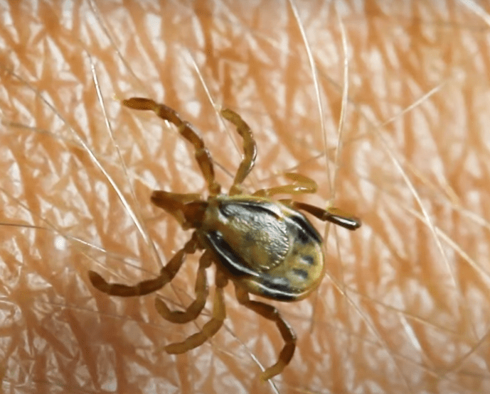 What to Do If You Find Tick in Your Hair: Removal & Prevention 10 image 154 image 154